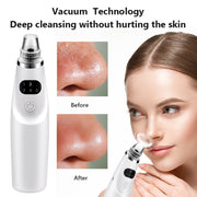electric blackhead remover vacuum suction tool, view 8 - MRSLM