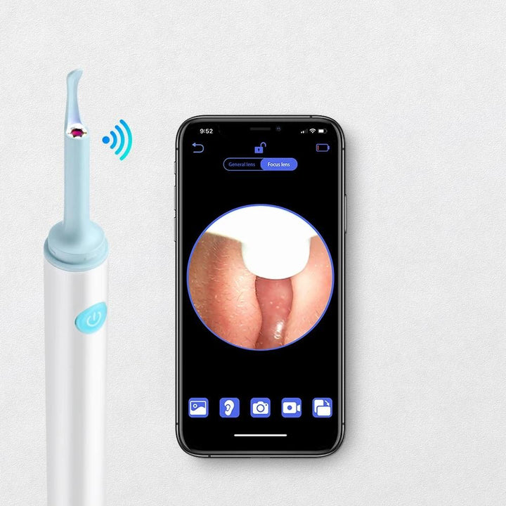 Wireless 3.9mm HD Ear Camera: Luminous Ear Cleaner & Otoscope