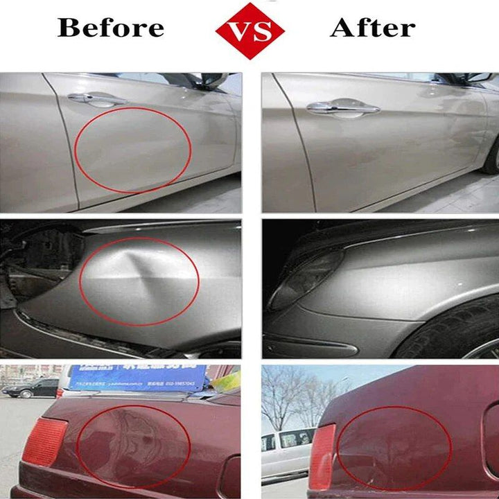 Professional Paintless Dent Repair Toolkit - Auto Body Work Slide Hammer Set
