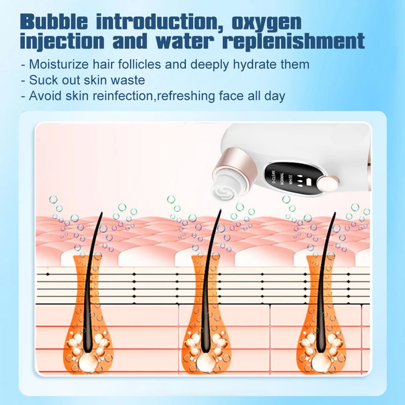 small bubble blackhead remover pore vacuum, view 6 - MRSLM