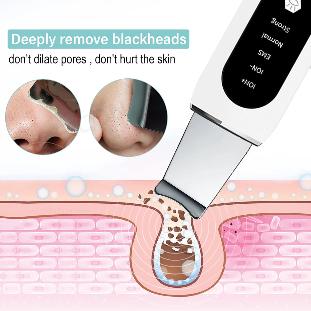 Ultrasonic Skin Scrubber: Deep Pore Cleanser & Blackhead Remover