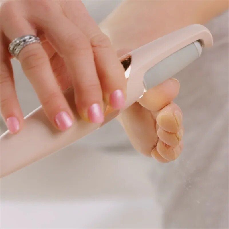 electric foot callus remover, view 4 - MRSLM