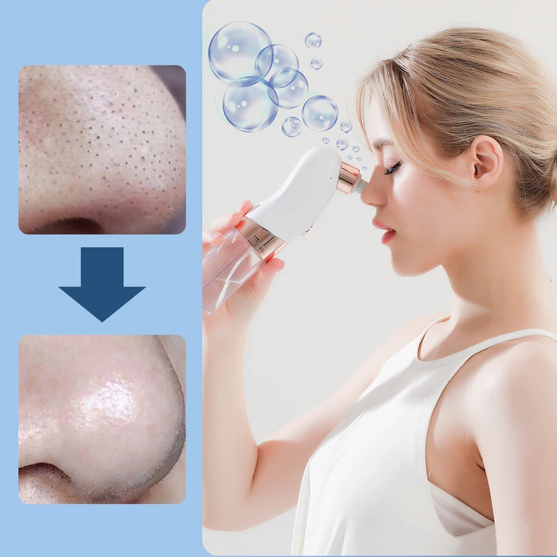electric pore vacuum and face cleaner, view 3 - MRSLM