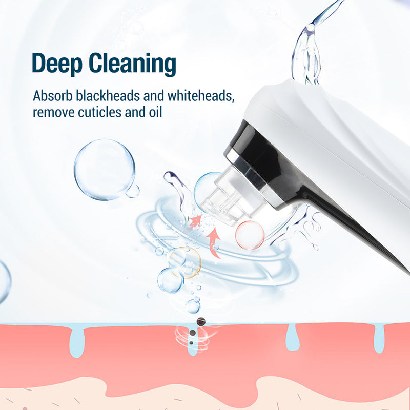 Electric pore vacuum, view 7 - MRSLM