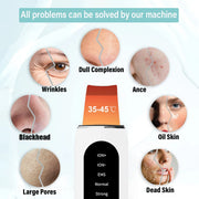Ultrasonic skin scrubber, view 4 - MRSLM