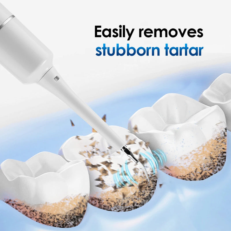 electric sonic vibration tooth cleaner, view 8 - MRSLM