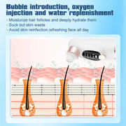 electric pore vacuum and face cleaner, view 5 - MRSLM