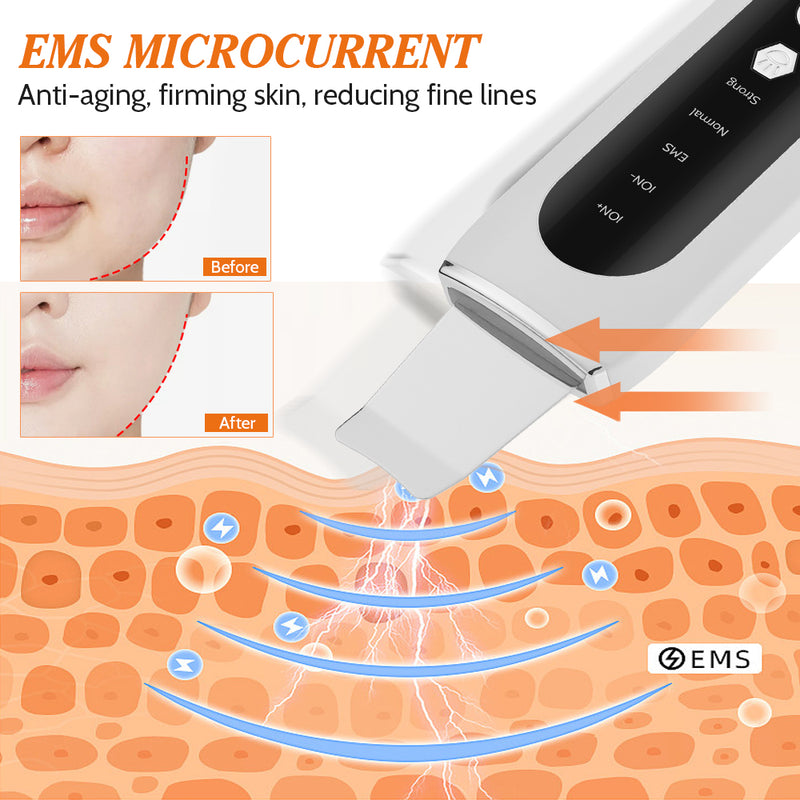 Ultrasonic facial peeling machine, view 5 - MRSLM