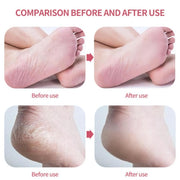 nano glass foot file, view 11 - MRSLM