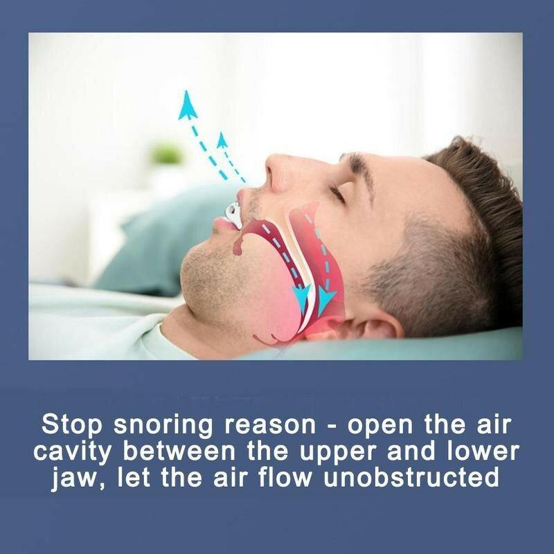 Anti Snoring Braces 3pc Portable Corrective Breathing Positioning Anti-snoring Silicone Braces Sleep Prevention Snoring Device - MRSLM