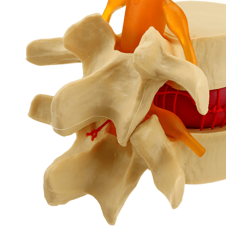 Medical Lumbar Vertebrae Model Props Anatomical Spine Herniation Teaching Tool - MRSLM