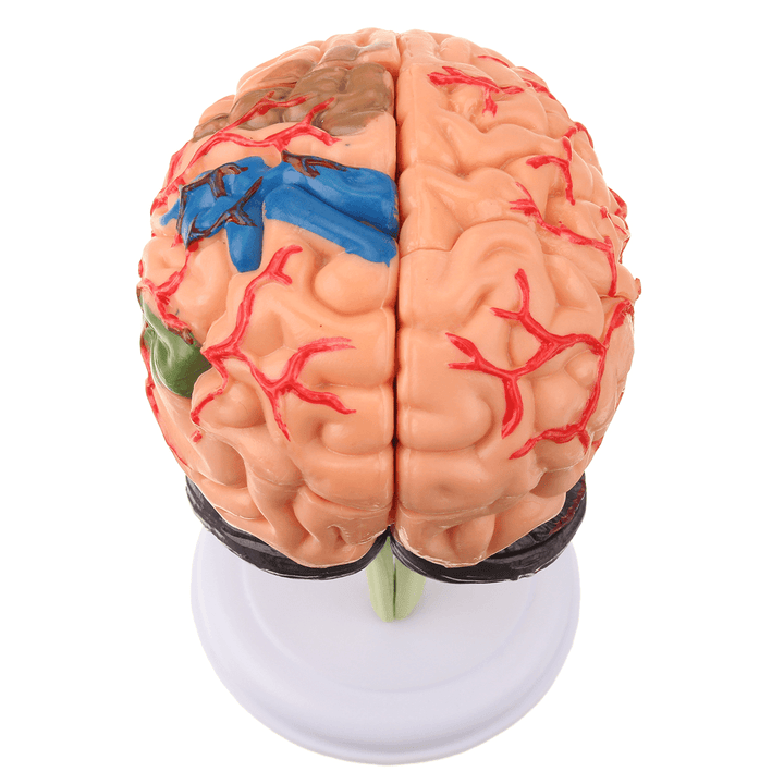 Human Brain Medical Model 4D Disassembled Anatomical School Educational Teaching Tool - MRSLM