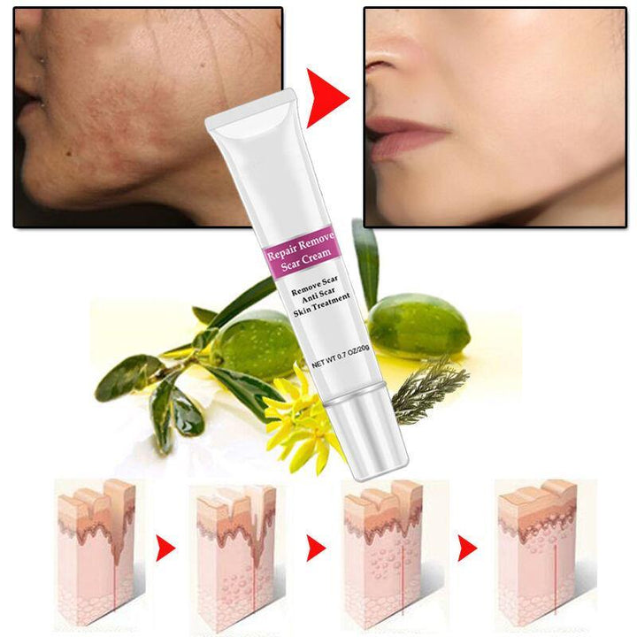 RtopR Facial Body Scar Removal Cream Repair Skin Weaken Marks Eliminate Pimple Promote Horny Layer Updating - MRSLM