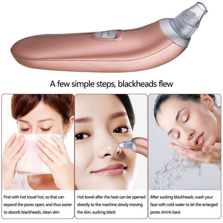 Blackhead Vacuum Acne Cleaner Pore Remover Electric Skin Facial Cleanser Care - MRSLM