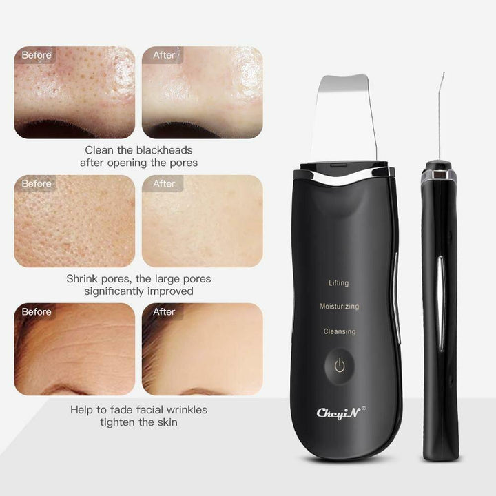 Ultrasonic Ion Deep Cleaning Skin Scrubber Peeling Shovel Facial Pore Cleaner Blackhead Remover Face Lifting USB Rechargeable Beauty Machine - MRSLM
