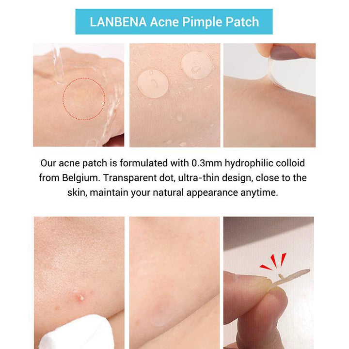 Acne Pimple Patch - MRSLM