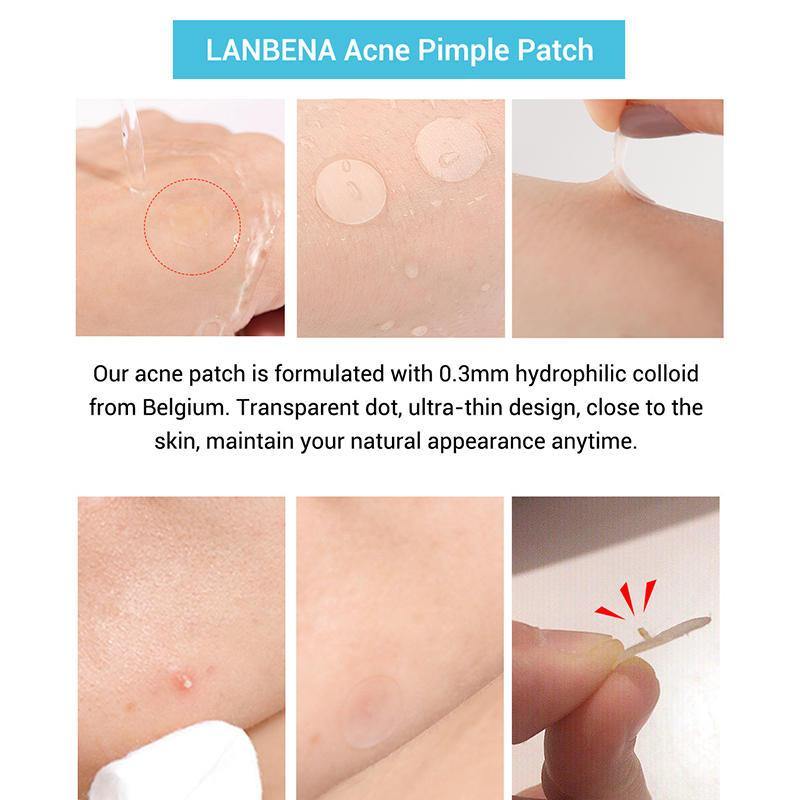 LANBENA Tea Tree Daily Acne Stickers + Night acne Stickers Fade Blackhead Acne Remover - MRSLM
