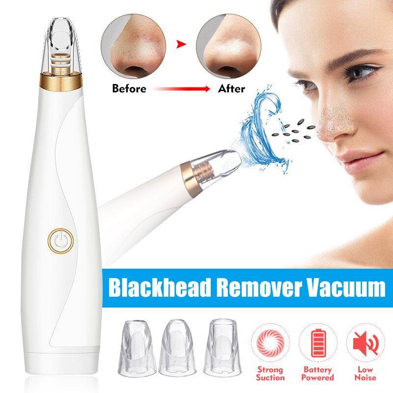 3 Blackhead Suction Device To Remove Blackheads Export Device Pore Cleaner Beauty Device - MRSLM