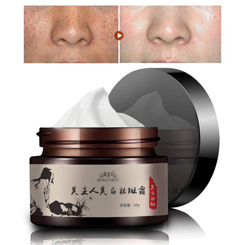 30g Freckle Cream Remove Sunburn Freckles Facial Cream (01#) - MRSLM