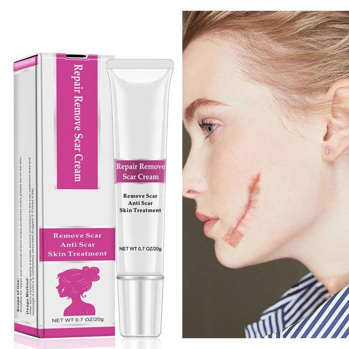RtopR Facial Body Scar Removal Cream Repair Skin Weaken Marks Eliminate Pimple Promote Horny Layer Updating - MRSLM
