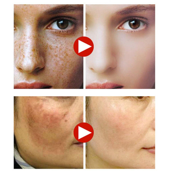 12 DAYS EFFECT! KMELE Day & Night Scar Removal Cream Face Anti Freckle Brighten Whitening US - MRSLM