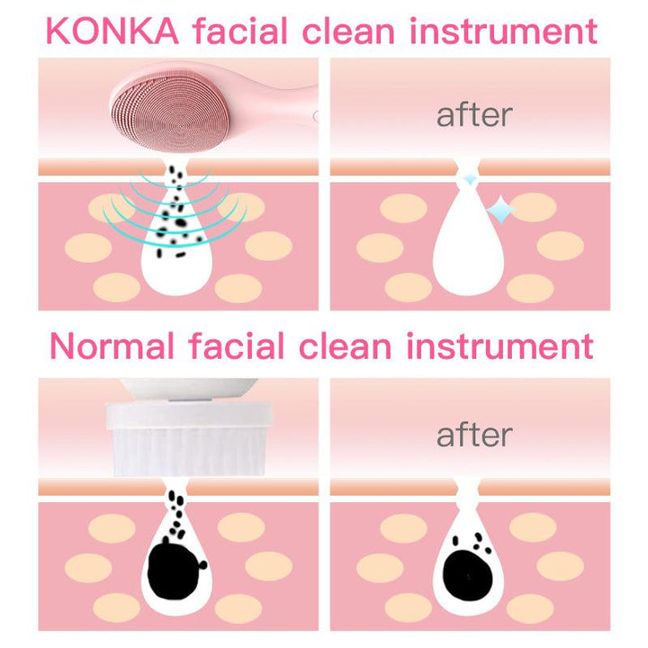 KONKA Electric face cleansing brush Silicone USB facial cleansing brush Skin care cleanine machine IPX6 waterproof (Pink) - MRSLM