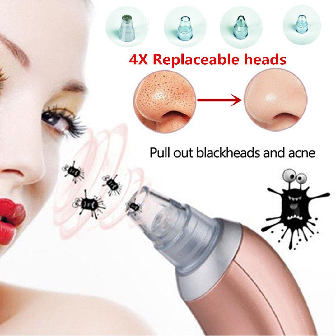 Blackhead Vacuum Acne Cleaner Pore Remover Electric Skin Facial Cleanser Care - MRSLM