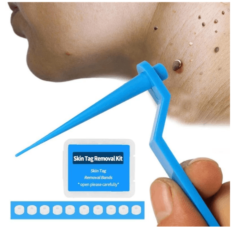 Skin Tag Kill Skin Mole Wart Remover Micro Band Skin Tag Removal Kit Adult Mole Wart Face Care - MRSLM