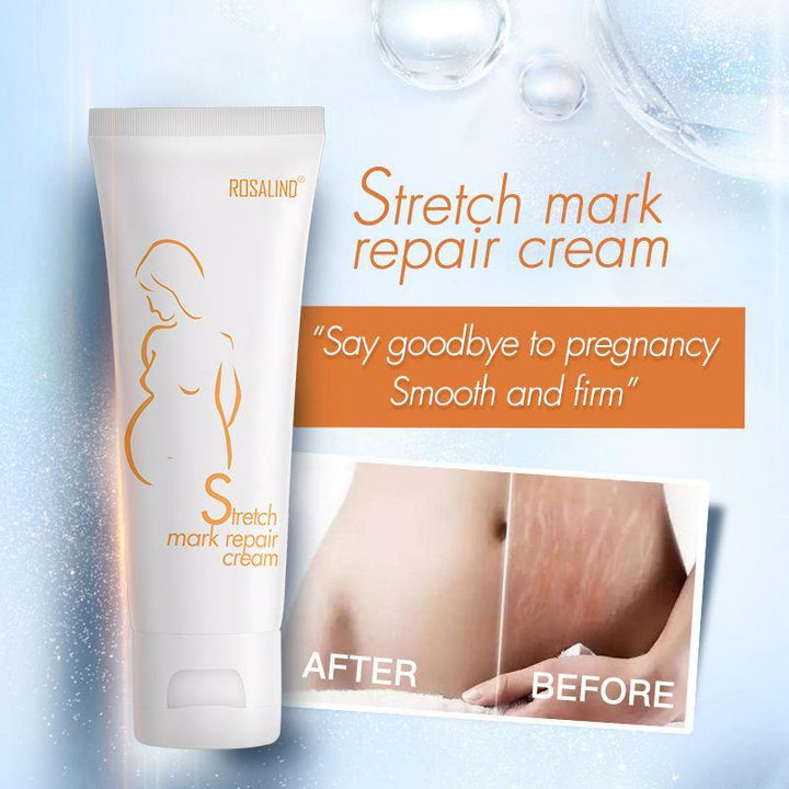 Rosalind Dilute Scar Acne Scars Stretch Marks To Stretch Marks Cream (#01) - MRSLM