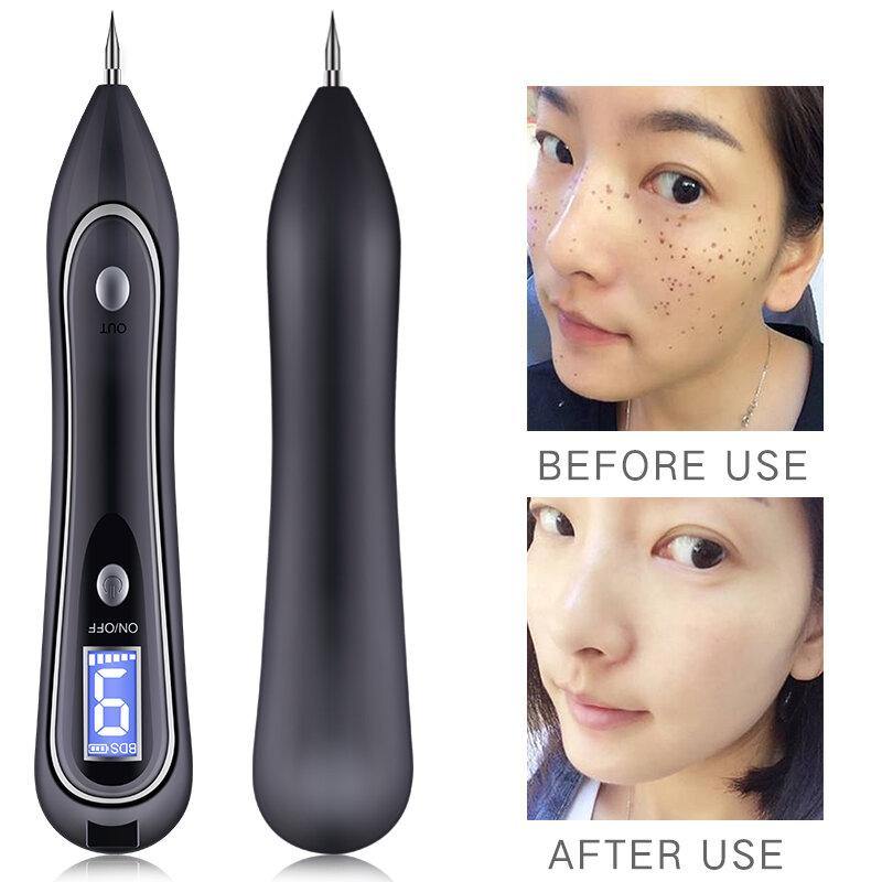 Skin Tag Repair Kit Portable Mole Remove Pen Professional Beauty Equipment - MRSLM
